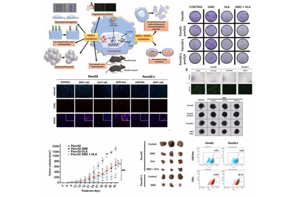 Investigación UGR cáncer páncreas