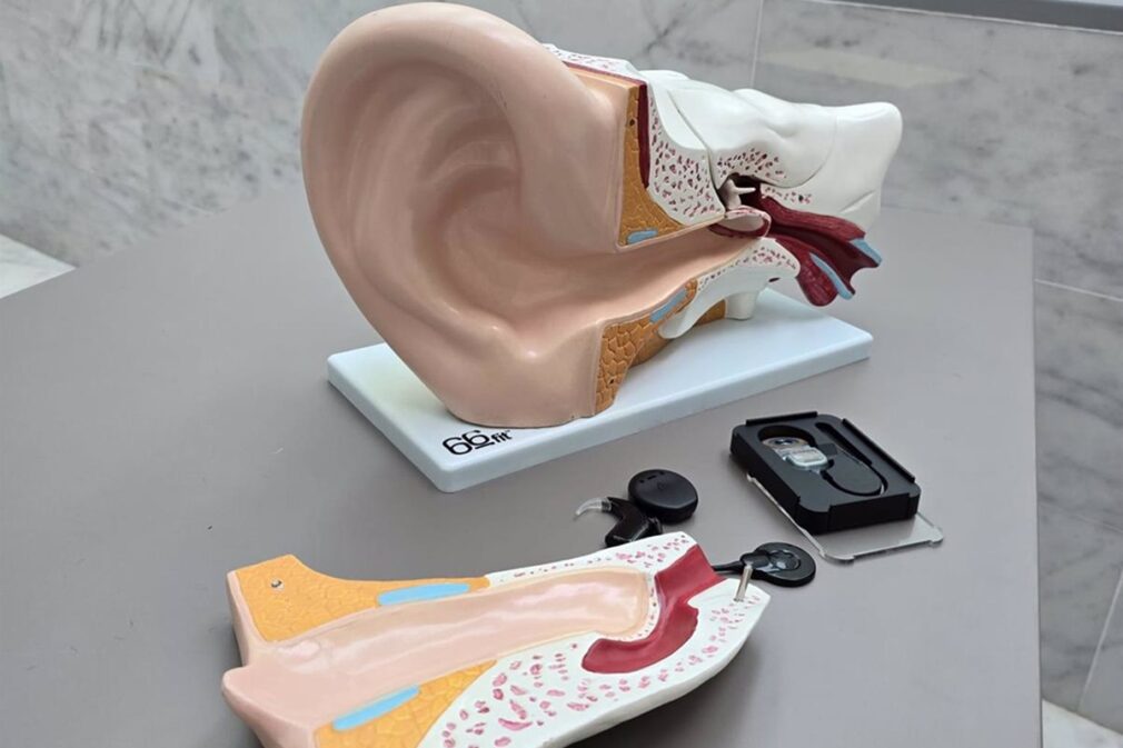 Granada.- Personas con sordera profunda recobran la audición con implantes cocleares en el Hospital Clínico San Cecilio